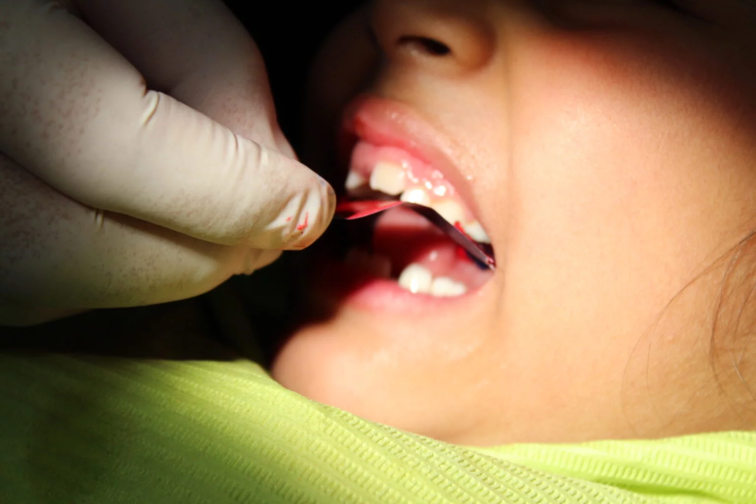 Tratamiento de periodoncia en Nakeji Dental