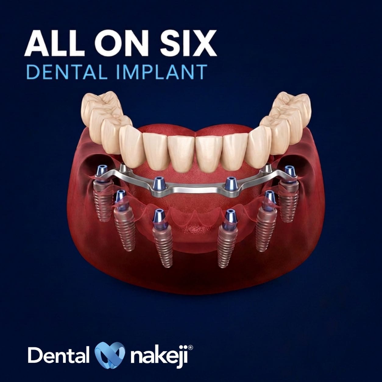 Promoción dental 1