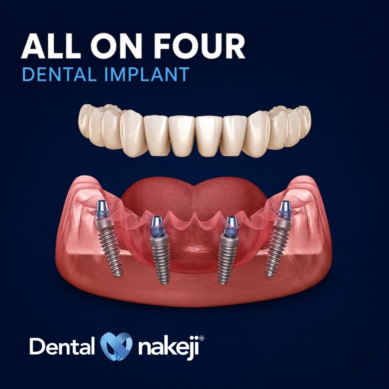 Promoción dental 2