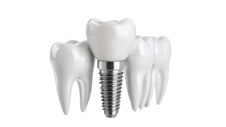 Implantes