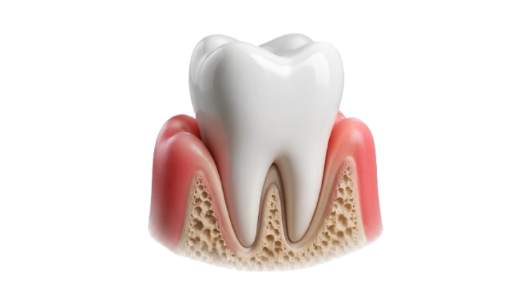 Periodoncia
