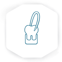 EXTRACCIÓN S EXTRACCIÓN S