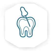 ROOT CANALS S ROOT CANALS S