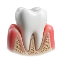 periodoncia